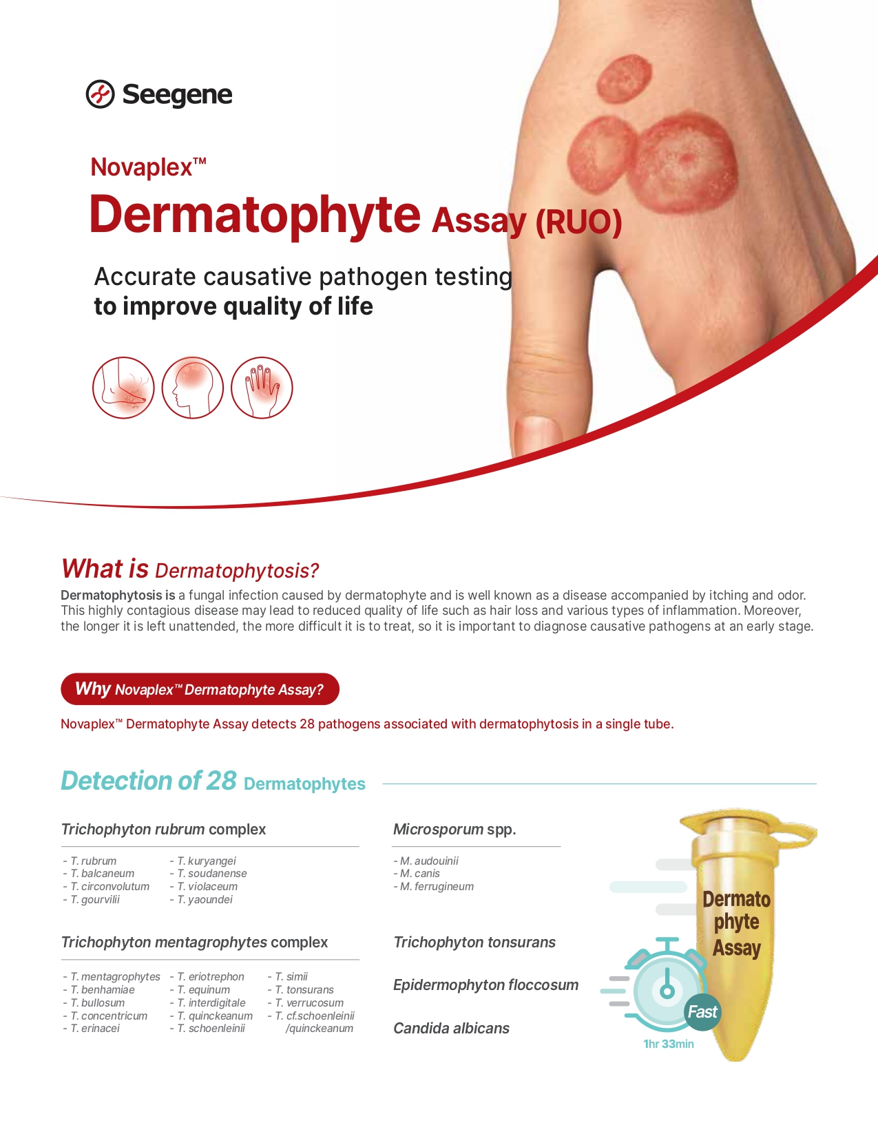 Novaplex™ Dermatophyte Assay (RUO)